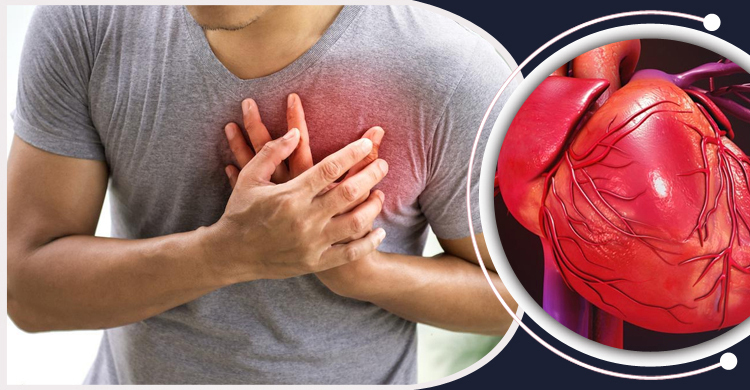 Who Should Consider Coronary Angioplasty
